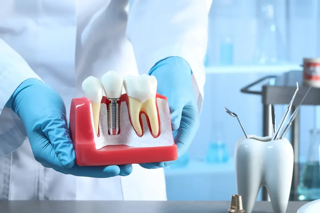 Dental Implants in Riverside, CA | Dr. Cole C. Scott, DDS