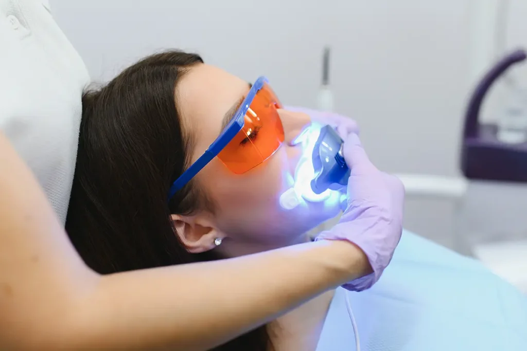 Teeth whitening